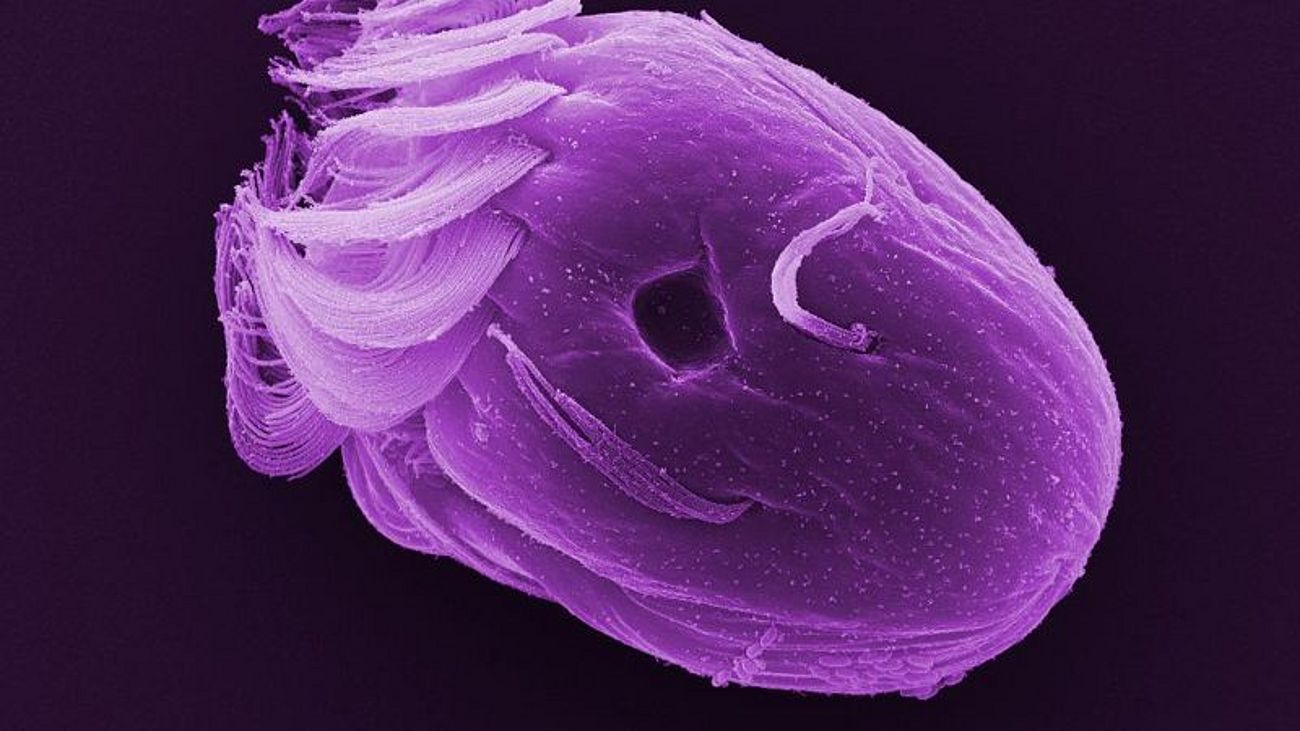 Halteria sp., das Springtierchen, ist ein Wimpertierchen, das bei der Nahrungsaufnahme von Bakterien sehr schnell auf der Stelle rotiert. Es kann aber auch in Bruchteilen einer Sekunde bis zu einem Millimeter weit springen.