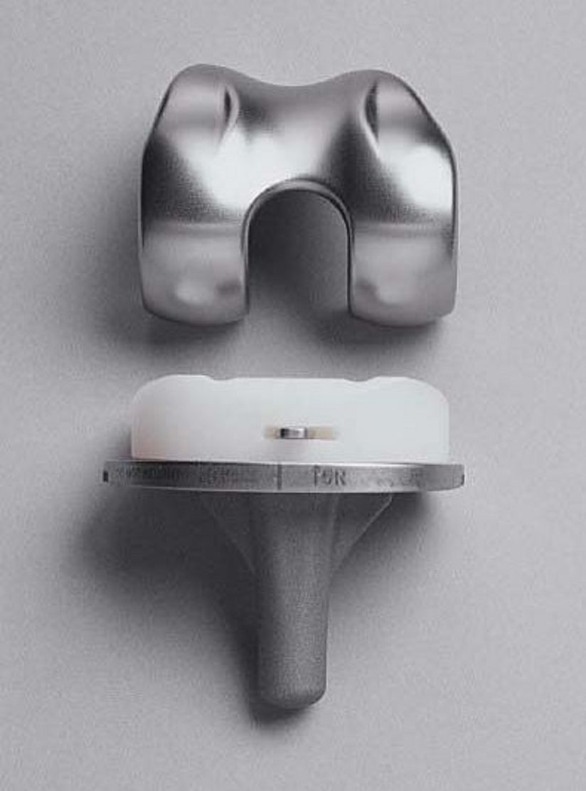 Beispiel eines Gelenkersatz.