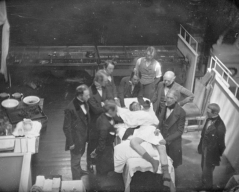 Ein Foto der berühmten ersten Operation mit Vollnarkose - nachgestellt.