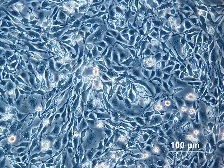 Vergrößerte Zellen in Zellkultur.