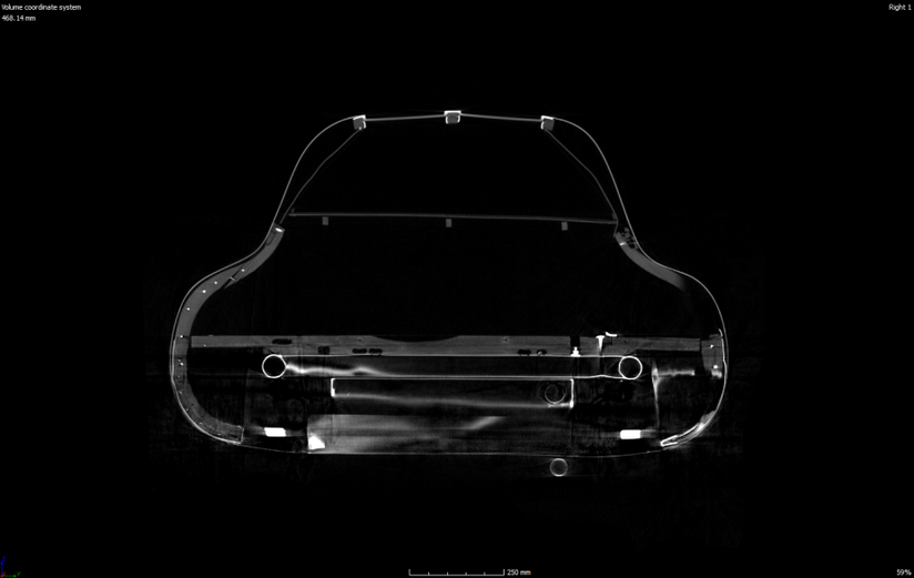 CT des hinteren Teils des Fahrzeugs.