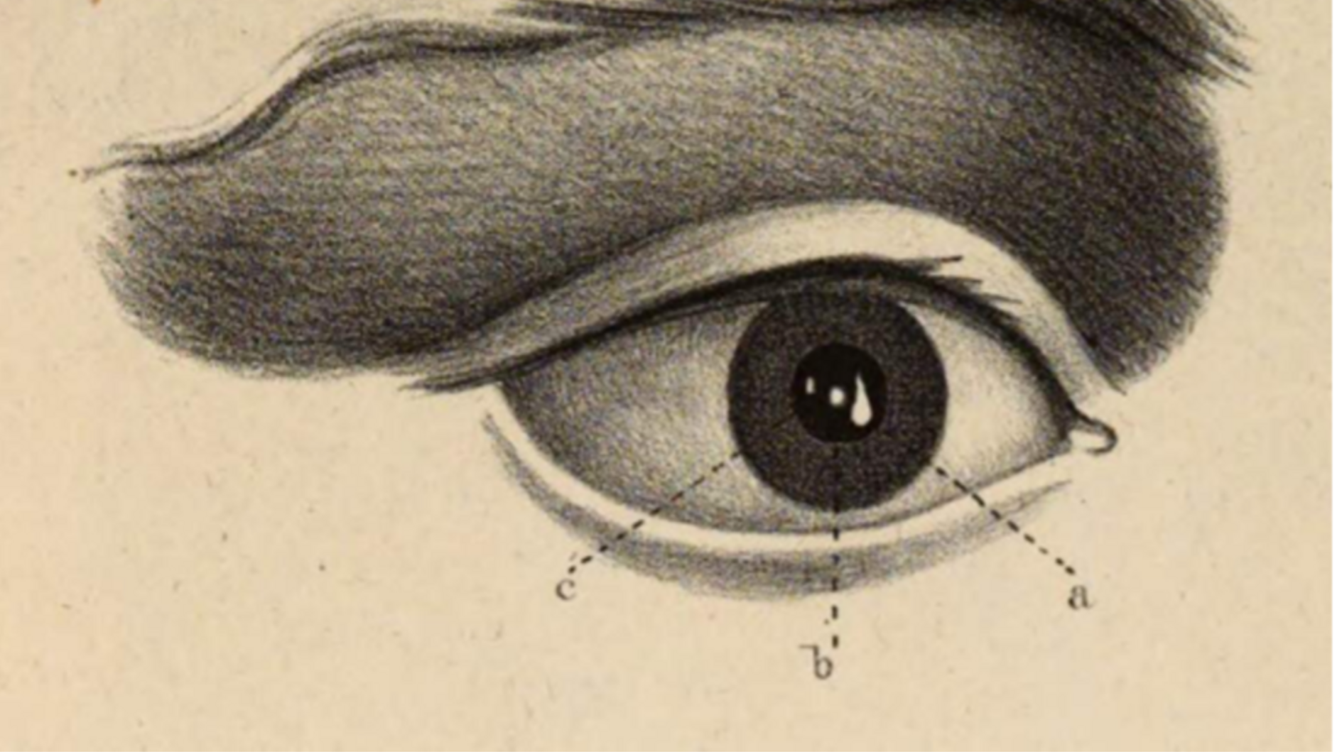 Darstellung der drei Purkinje-Sanson-Bilder.