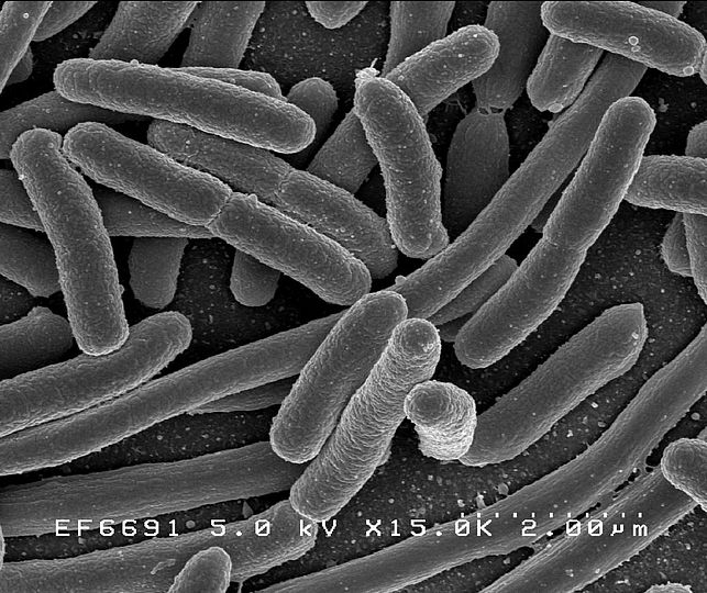 Aufnahme von Escherichia coli Bakterien mit dem Rasterelektronenmikroskop.