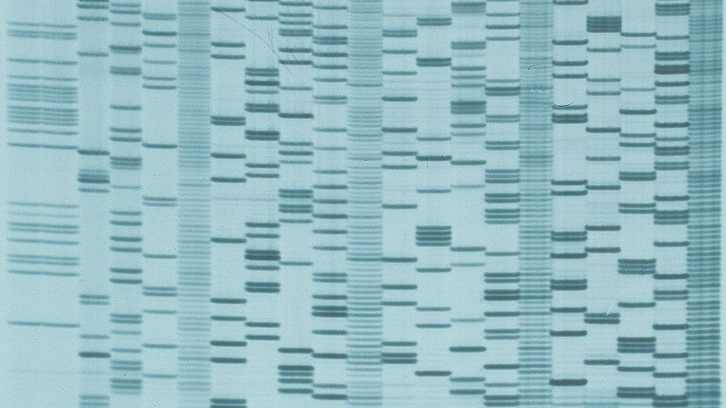 Muster der DNA-Fragment.