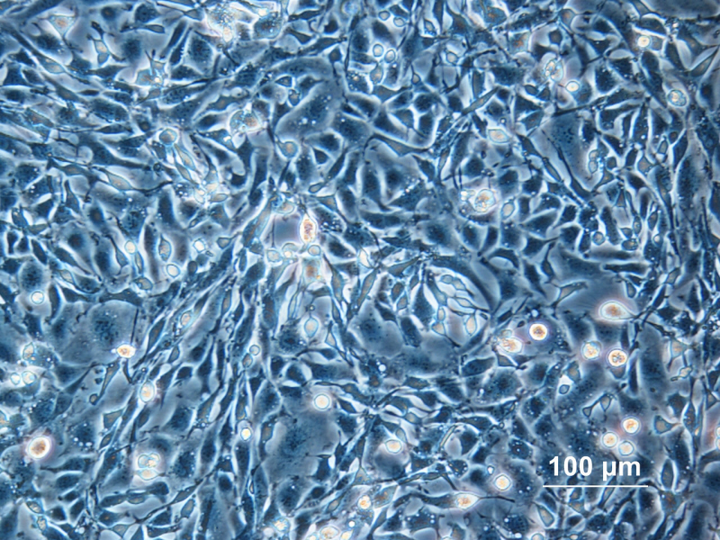 Zellkultur von sogenannten CHO (Chinese Hamster Ovary) Zellen.