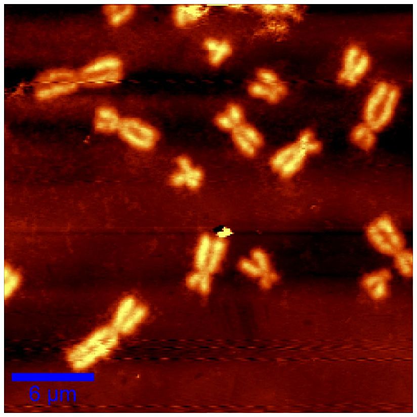 Chromosomen in ihrer kompakten Form.