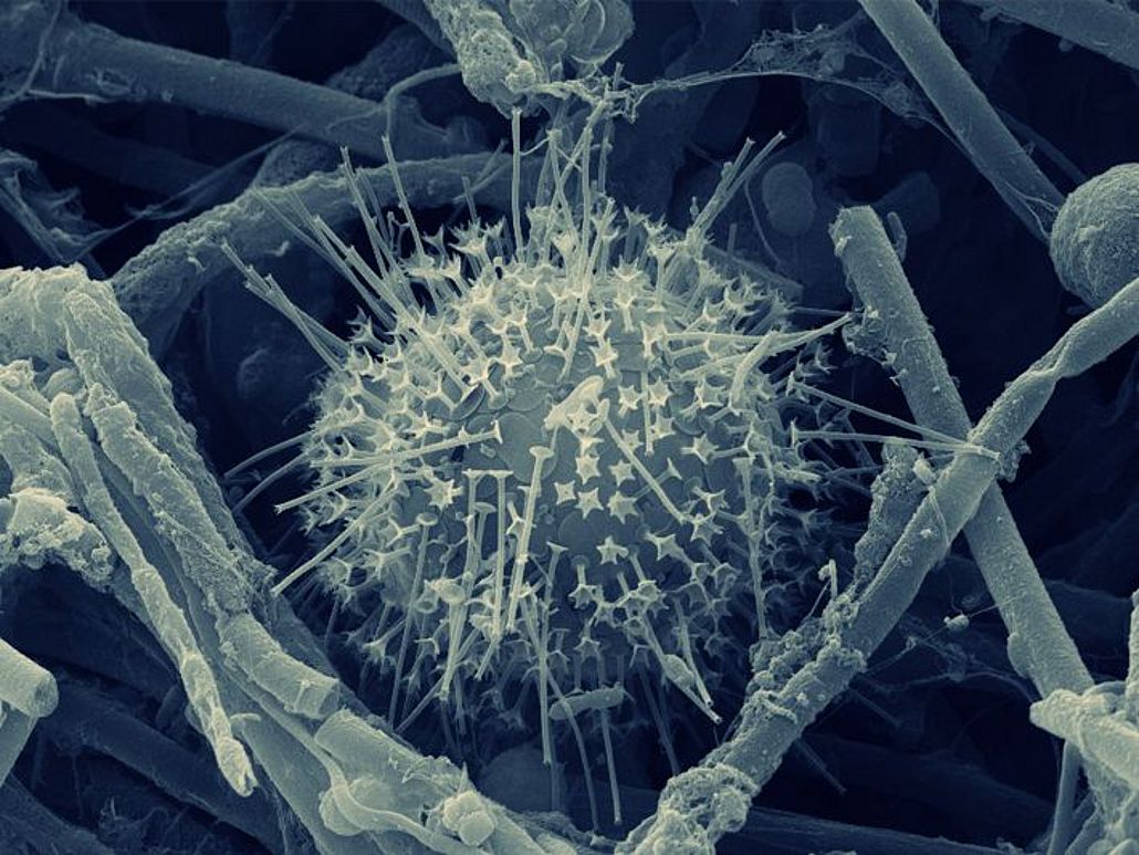 Goldalge unter dem Rasterelektronenmikroskop.