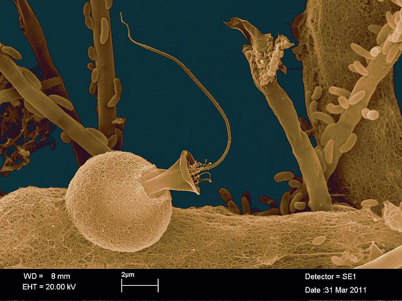 Bechergeißeltierchen.