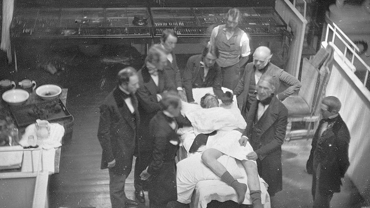 Ein Foto der berühmten ersten Operation mit Vollnarkose - nachgestellt.