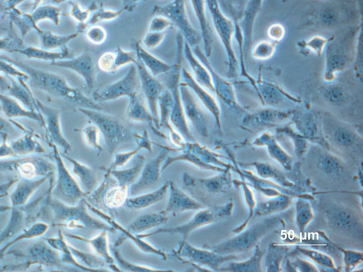 Mikroskopische Aufnahme von CHO-Zellen.