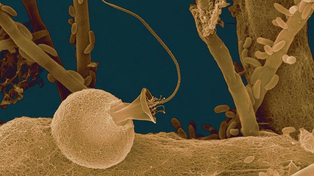 Dieses kleine, fest sitzende, Bechergeißeltierchen frisst gerne Bakterien, die es mit enorm schnellen Bewegungen der Geißel in den Zellkörper befördert.